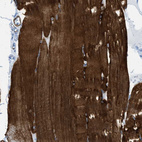 Immunohistochemical staining of human skeletal muscle shows strong cytoplasmic positivity in striated muscle fibers.