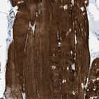 Immunohistochemical staining of human skeletal muscle shows strong cytoplasmic positivity in striated muscle fibers.