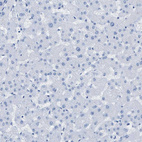 Immunohistochemical staining of human liver shows no positivity as expected.