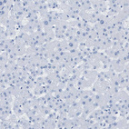 Anti-DES Antibody