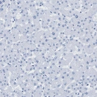 Immunohistochemical staining of human liver shows no positivity as expected.