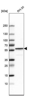 Western blot analysis in human cell line RH-30.