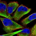 Immunofluorescent staining of human cell line RH-30 shows localization to intermediate filaments.