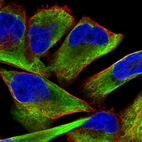 Immunofluorescent staining of human cell line RH-30 shows localization to intermediate filaments.