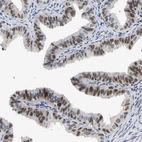 Anti-NLE1 Antibody