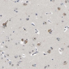 Immunohistochemical staining of human cerebral cortex shows moderate nucleoli positivity in neurons.