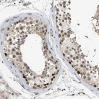Immunohistochemical staining of human testis shows moderate nucleoli and nuclear positivity in subset of cells in seminiferous ducts.