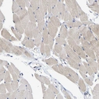 Immunohistochemical staining of human skeletal muscle shows no nuclear positivity in myocytes as expected.