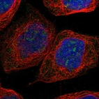 Immunofluorescent staining of human cell line A-431 shows positivity in nucleus & nucleoli.