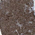 Anti-SLC43A1 Antibody