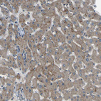 Immunohistochemical staining of human liver shows moderate membranous positivity in hepatocytes.