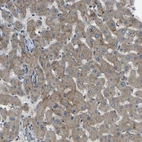 Immunohistochemical staining of human liver shows moderate membranous positivity in hepatocytes.