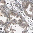 Immunohistochemical staining of human endometrium shows moderate membranous positivity in glandular cells.
