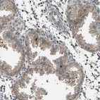 Immunohistochemical staining of human endometrium shows moderate membranous positivity in glandular cells.