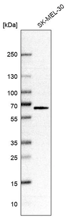Western blot analysis in human cell line SK-MEL-30.