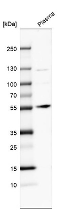 Western blot analysis in human plasma.