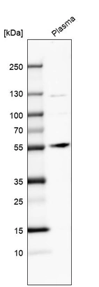 Western blot analysis in human plasma.