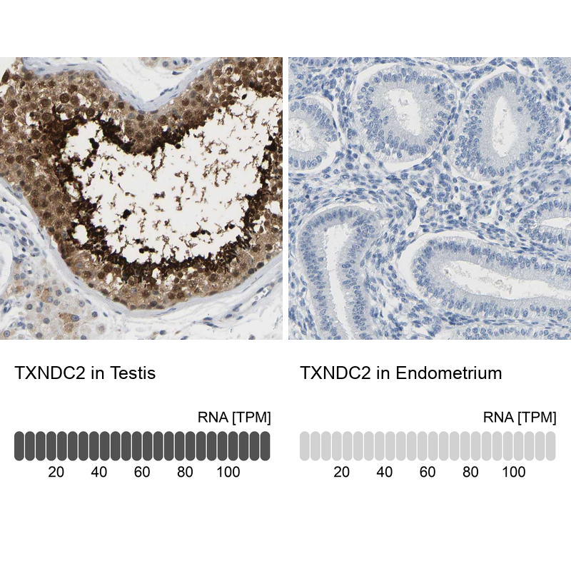 Anti-TXNDC2 Antibody