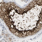 Immunohistochemical staining of human testis shows high expression.