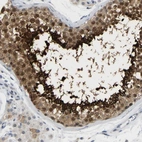 Immunohistochemical staining of human testis shows high expression.