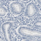 Immunohistochemical staining of human endometrium shows low expression as expected.