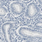 Immunohistochemical staining of human endometrium shows low expression as expected.