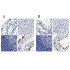 Immunohistochemical staining of human colon, liver, lymph node and testis using Anti-HOOK1 antibody HPA018820 (A) shows similar protein distribution across tissues to independent antibody HPA018537 (B).