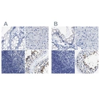 Immunohistochemical staining of human colon, liver, lymph node and testis using Anti-HOOK1 antibody HPA018820 (A) shows similar protein distribution across tissues to independent antibody HPA018537 (B).