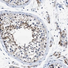 Immunohistochemical staining of human testis shows high expression.
