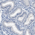 Immunohistochemical staining of human endometrium shows low expression as expected.