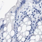 Immunohistochemical staining of human colon using Anti-HOOK1 antibody HPA018820.