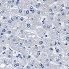 Immunohistochemical staining of human liver using Anti-HOOK1 antibody HPA018820.