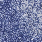 Immunohistochemical staining of human lymph node using Anti-HOOK1 antibody HPA018820.