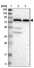 Lane 1: Marker [kDa] 230, 130, 95, 72, 56, 36, 28, 17, 11_br/_Lane 2: Human cell line RT-4_br/_Lane 3: Human cell line U-251MG sp