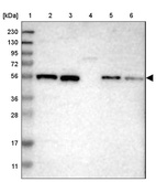 Lane 1: Marker [kDa] 230, 130, 95, 72, 56, 36, 28, 17, 11_br/_Lane 2: Human cell line RT-4_br/_Lane 3: Human cell line U-251MG sp_br/_Lane 4: Human plasma (IgG/HSA depleted)_br/_Lane 5: Human liver tissue_br/_Lane 6: Human tonsil tissue