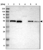 Lane 1: Marker [kDa] 230, 130, 95, 72, 56, 36, 28, 17, 11_br/_Lane 2: Human cell line RT-4_br/_Lane 3: Human cell line U-251MG sp_br/_Lane 4: Human plasma (IgG/HSA depleted)_br/_Lane 5: Human liver tissue_br/_Lane 6: Human tonsil tissue