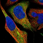 Immunofluorescent staining of human cell line U-2 OS shows positivity in cytoplasm.