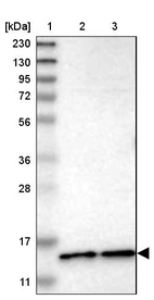 Lane 1: Marker [kDa] 230, 130, 95, 72, 56, 36, 28, 17, 11_br/_Lane 2: Human cell line RT-4_br/_Lane 3: Human cell line U-251MG sp