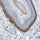 Immunohistochemical staining of human skin shows strong membranous positivity in keratinocytes.
