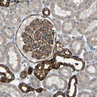 Anti-SLC43A1 Antibody