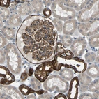Immunohistochemical staining of human kidney shows strong cytoplasmic positivity in cells in tubules.