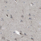 Immunohistochemical staining of human cerebral cortex shows weak to moderate cytoplasmic positivity in neurons.