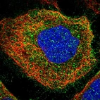 Immunofluorescent staining of human cell line A-431 shows localization to plasma membrane & vesicles.