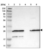 Lane 1: Marker [kDa] 230, 130, 95, 72, 56, 36, 28, 17, 11_br/_Lane 2: Human cell line RT-4_br/_Lane 3: Human cell line U-251MG sp_br/_Lane 4: Human plasma (IgG/HSA depleted)_br/_Lane 5: Human liver tissue_br/_Lane 6: Human tonsil tissue