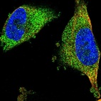 Immunofluorescent staining of human cell line U-251 MG shows localization to cytosol.
