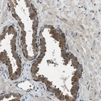 Immunohistochemical staining of human prostate shows moderate cytoplasmic positivity in glandular cells.