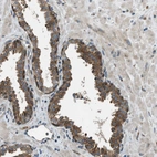 Immunohistochemical staining of human prostate shows moderate cytoplasmic positivity in glandular cells.