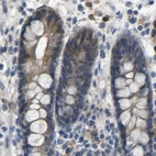 Immunohistochemical staining of human colon using Anti-FHIT antibody HPA018840.