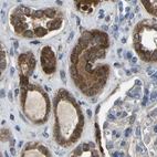 Immunohistochemical staining of human kidney using Anti-FHIT antibody HPA018840.