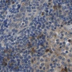 Immunohistochemical staining of human lymph node using Anti-FHIT antibody HPA018840.